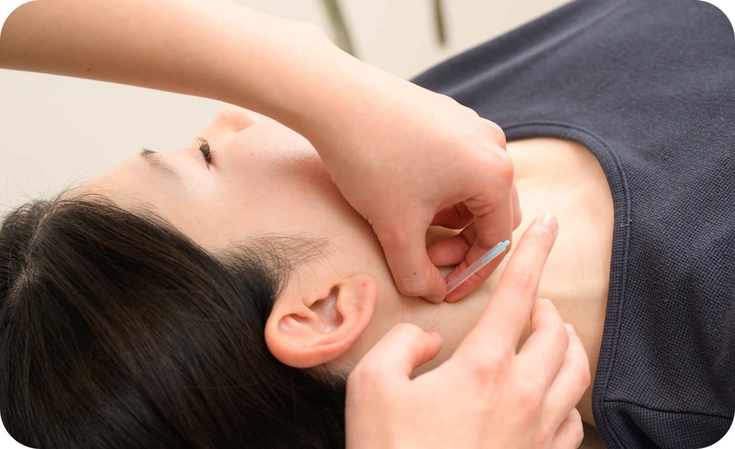 鍼とマッサージで20分